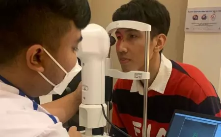 Mata Minus Turun Setelah Seminggu Penggunaan