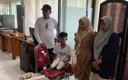 Dinsos Kabupaten Probolinggo Fasilitasi Pengukuran Bantuan Kaki Palsu Bagi Penyandang Disabilitas